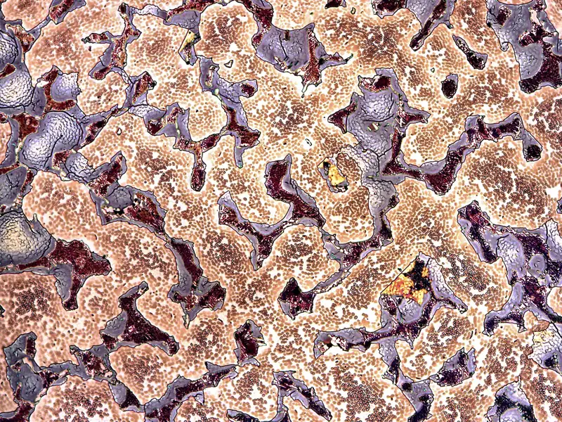 Micrografia de bronze ao estanho fundido mostrando dendritas da fase alfa e regiões interdendríticas